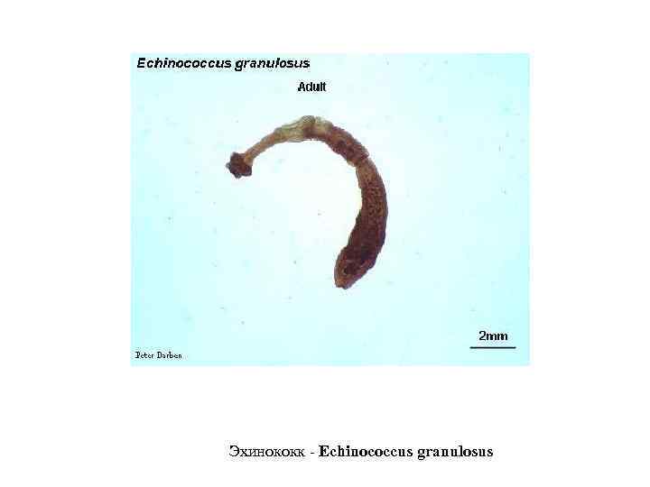 Эхинококк - Echinococcus granulosus 