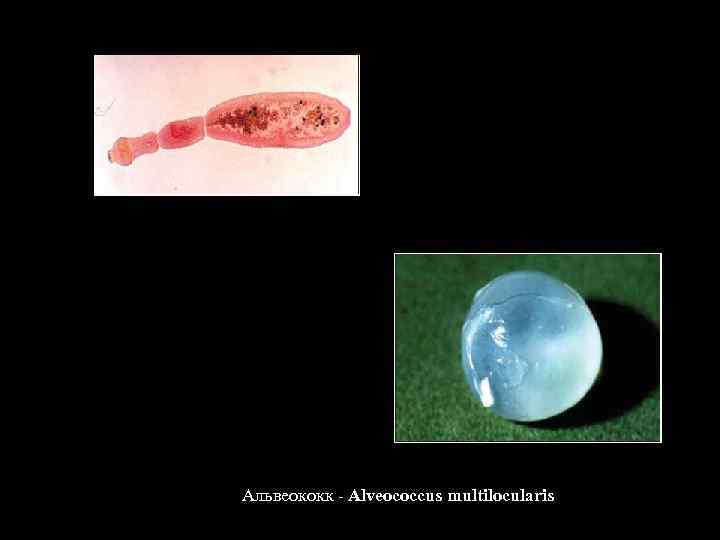 Альвеококк - Alveococcus multilocularis 