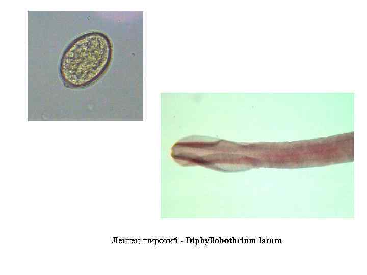Строение лентеца широкого (Diphyllobothrium latum). Широкий лентец дифиллоботриоз.