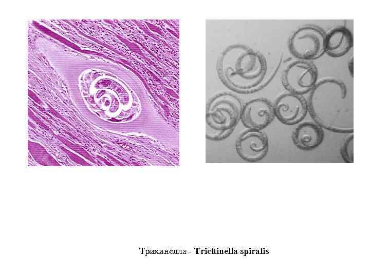 Трихинелла - Trichinella spiralis 