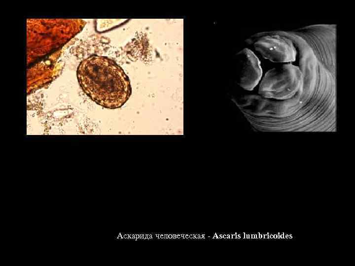 Аскарида человеческая - Ascaris lumbricoides 