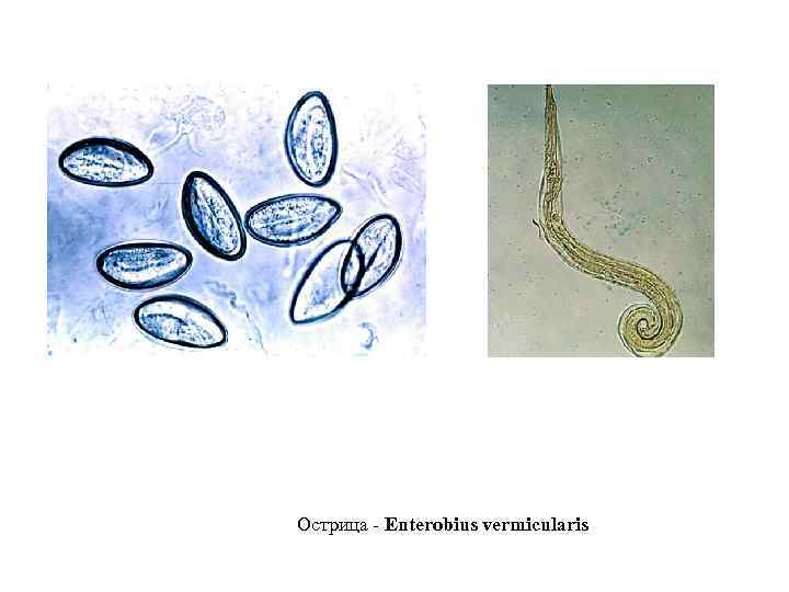 Острица - Enterobius vermicularis 