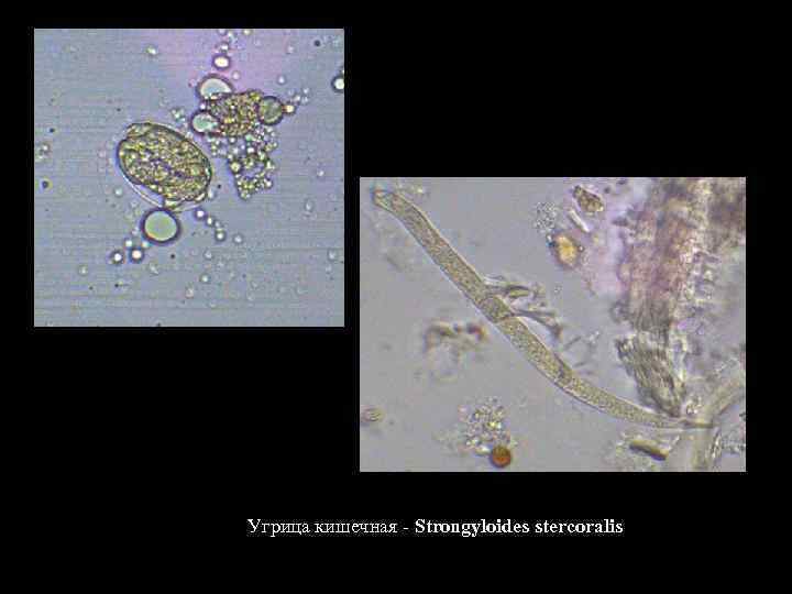 Угрица кишечная - Strongyloides stercoralis 