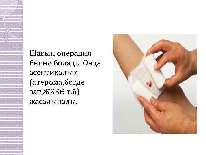 Шағын операция бөлме болады. Онда асептикалық (атерома, бөгде зат, ЖХБӨ т. б) жасалынады. 