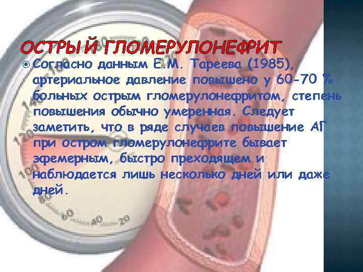 ОСТРЫЙ ГЛОМЕРУЛОНЕФРИТ Согласно данным Е. М. Тареева (1985), артериальное давление повышено у 60 -70