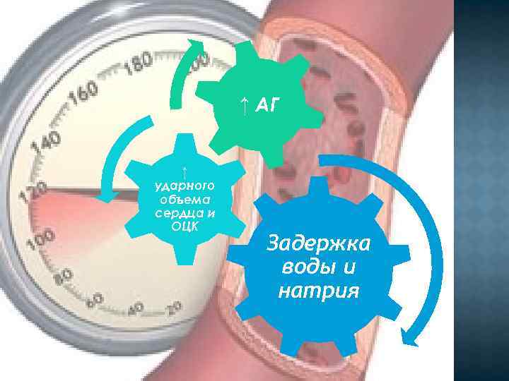 ↑ АГ ↑ ударного объема сердца и ОЦК Задержка воды и натрия 