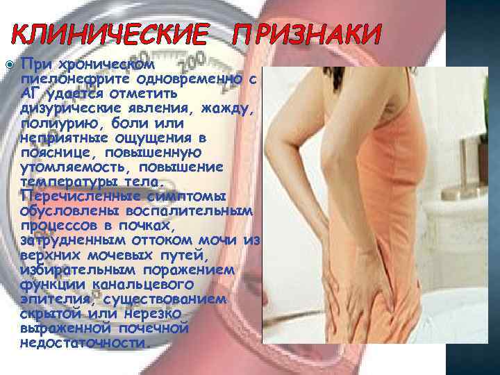 КЛИНИЧЕСКИЕ ПРИЗНАКИ При хроническом пиелонефрите одновременно с АГ удается отметить дизурические явления, жажду, полиурию,