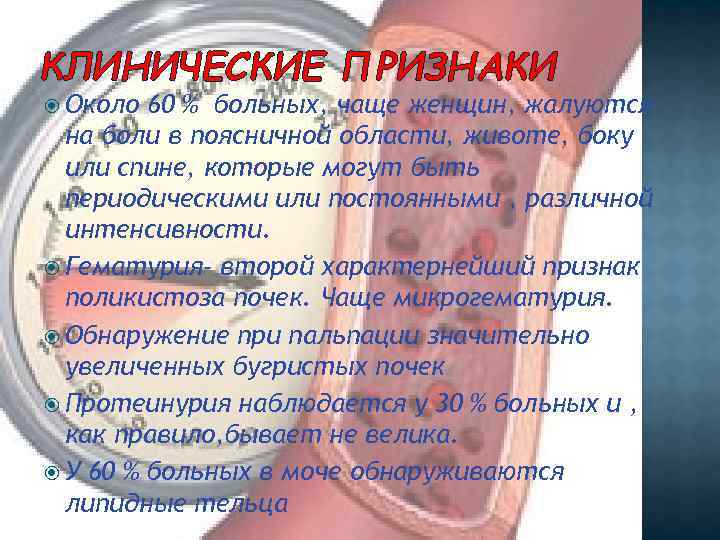 КЛИНИЧЕСКИЕ ПРИЗНАКИ Около 60 % больных, чаще женщин, жалуются на боли в поясничной области,