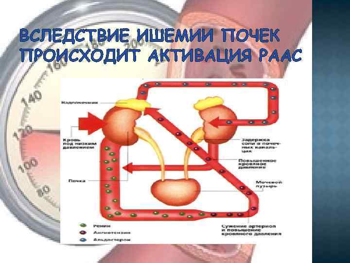 ВСЛЕДСТВИЕ ИШЕМИИ ПОЧЕК ПРОИСХОДИТ АКТИВАЦИЯ РААС 