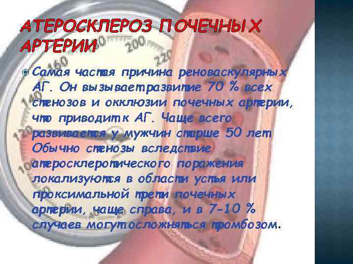 АТЕРОСКЛЕРОЗ ПОЧЕЧНЫХ АРТЕРИИ Самая частая причина реноваскулярных АГ. Он вызывает развитие 70 % всех