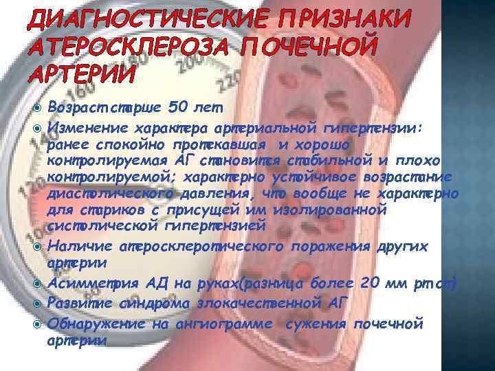 ДИАГНОСТИЧЕСКИЕ ПРИЗНАКИ АТЕРОСКЛЕРОЗА ПОЧЕЧНОЙ АРТЕРИИ Возраст старше 50 лет Изменение характера артериальной гипертензии: ранее