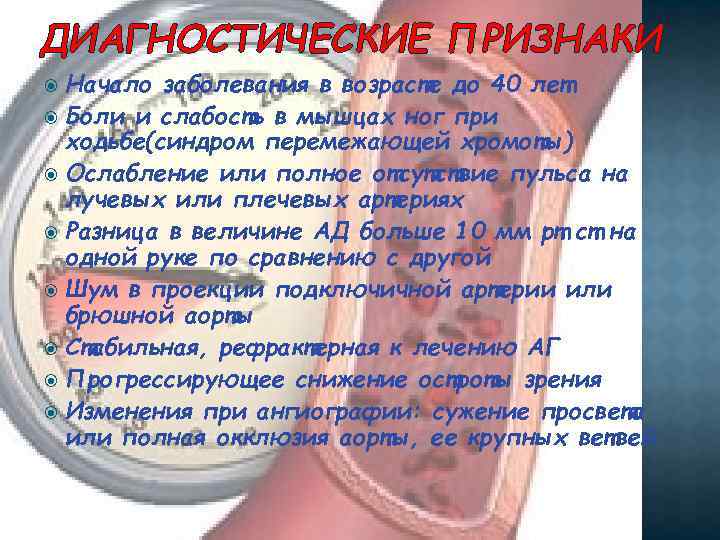 ДИАГНОСТИЧЕСКИЕ ПРИЗНАКИ Начало заболевания в возрасте до 40 лет Боли и слабость в мышцах