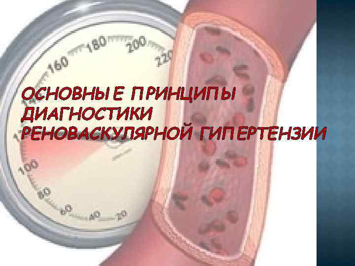 ОСНОВНЫЕ ПРИНЦИПЫ ДИАГНОСТИКИ РЕНОВАСКУЛЯРНОЙ ГИПЕРТЕНЗИИ 