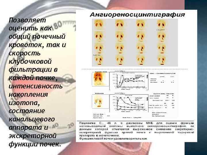 Позволяет оценить как общий почечный кровоток, так и скорость клубочковой фильтрации в каждой почке,