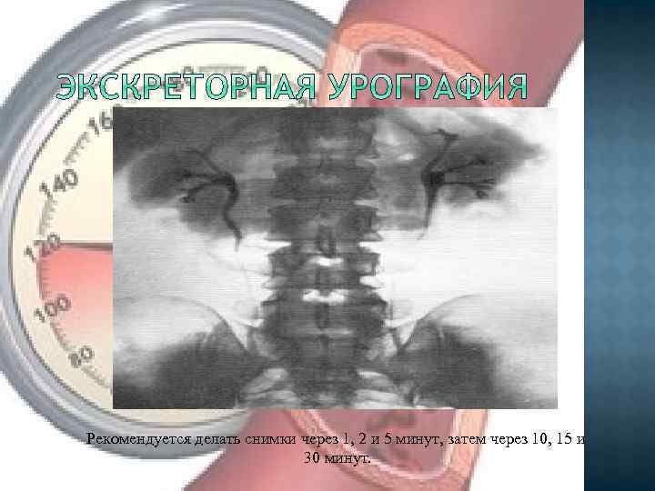 Рекомендуется делать снимки через 1, 2 и 5 минут, затем через 10, 15 и