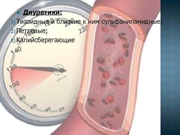 Диуретики: 1) Тиазидные и близкие к ним сульфаниламидные; 2) Петлевые; 3) Калийсберегающие 