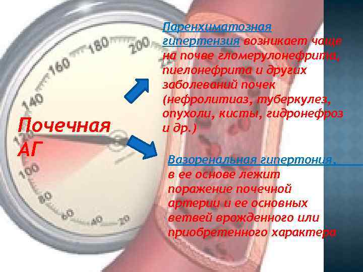 Почечная АГ Паренхиматозная гипертензия возникает чаще на почве гломерулонефрита, пиелонефрита и других заболеваний почек