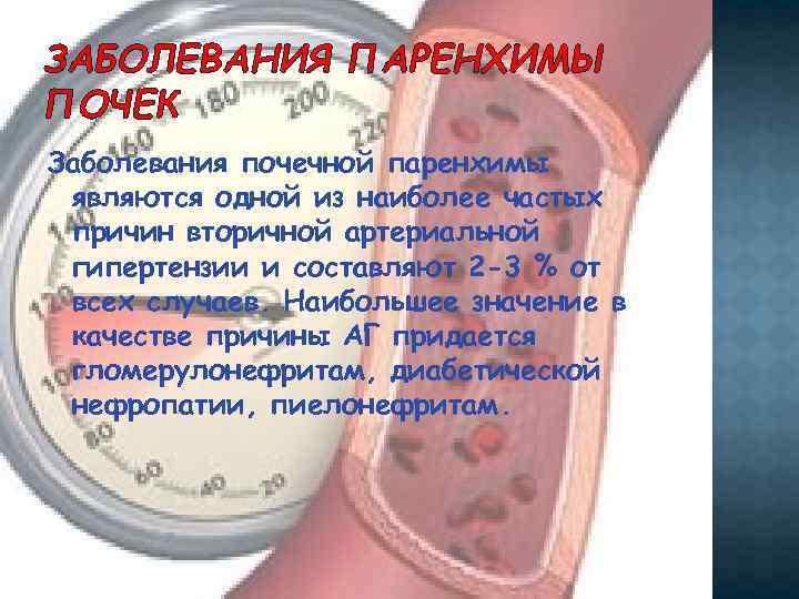 ЗАБОЛЕВАНИЯ ПАРЕНХИМЫ ПОЧЕК Заболевания почечной паренхимы являются одной из наиболее частых причин вторичной артериальной