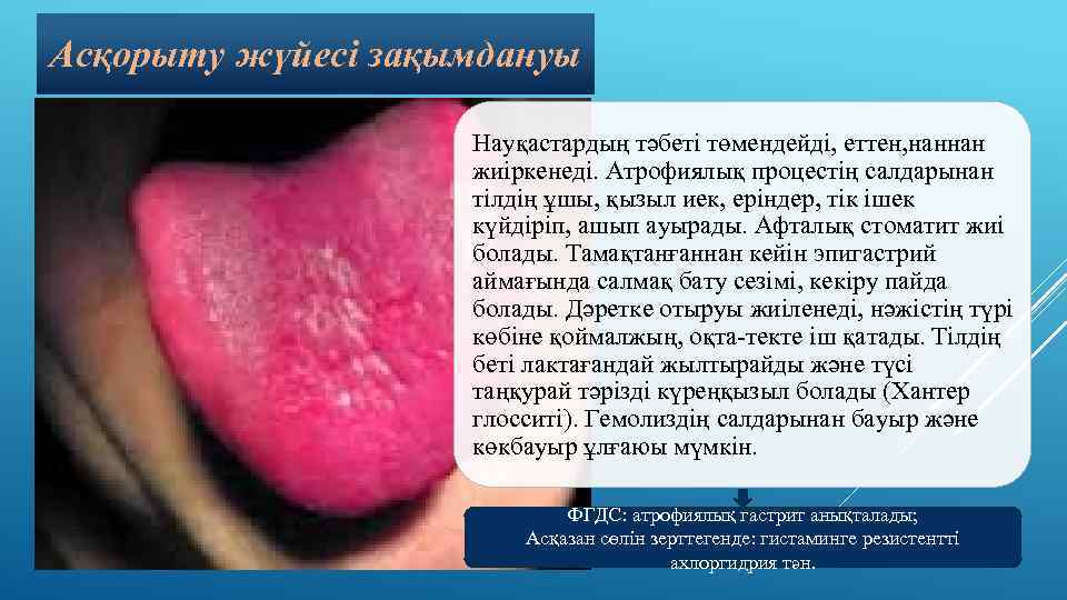 Асқорыту жүйесі зақымдануы Науқастардың тәбеті төмендейді, еттен, наннан жиіркенеді. Атрофиялық процестің салдарынан тілдің ұшы,