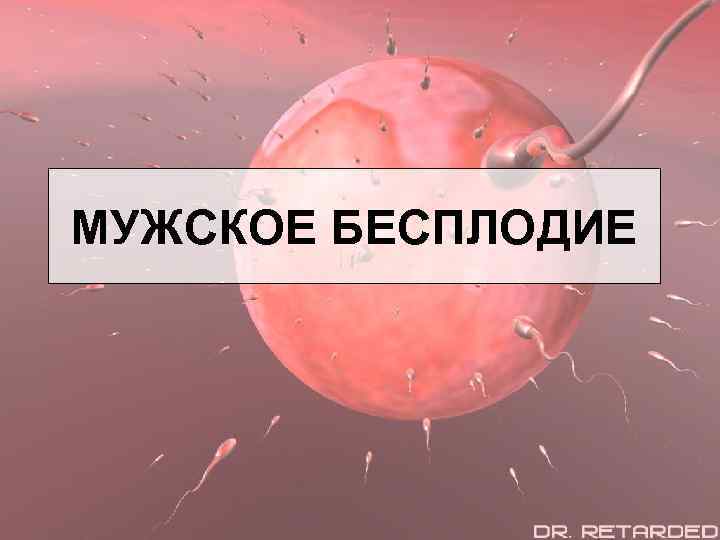 МУЖСКОЕ БЕСПЛОДИЕ 