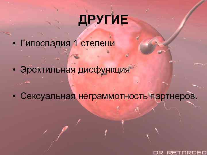 ДРУГИЕ • Гипоспадия 1 степени • Эректильная дисфункция • Сексуальная неграммотность партнеров. 