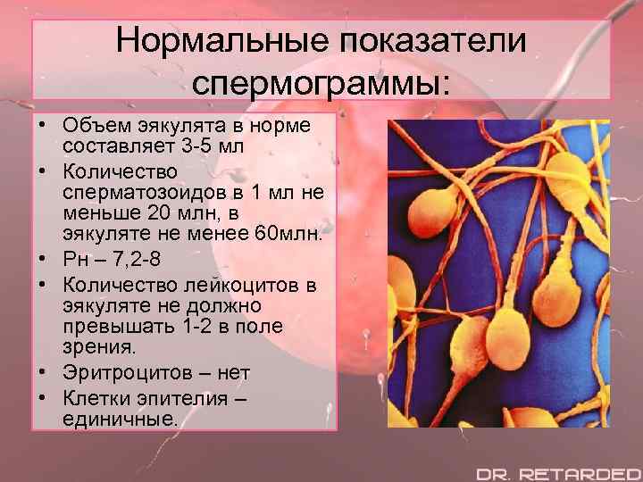Нормальные показатели спермограммы: • Объем эякулята в норме составляет 3 -5 мл • Количество