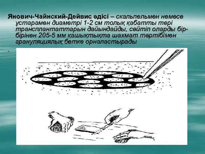 Янович-Чайнский-Дейвис әдісі – скальпельмен немесе ұстарамен диаметрі 1 -2 см толық қабатты тері трансплантаттарын