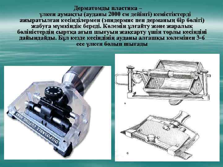 Дерматомды пластика – үлкен аумақты (ауданы 2000 см дейінгі) кемістіктерді ажыратылған кесінділермен (эпидермис пен