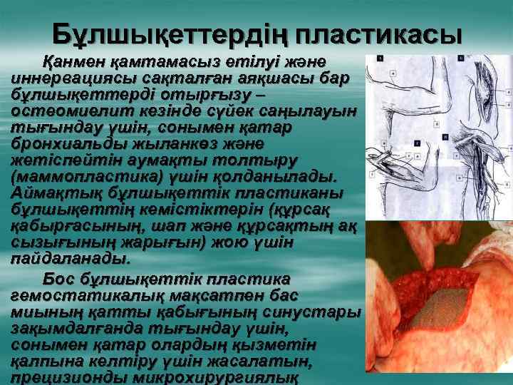 Бұлшықеттердің пластикасы Қанмен қамтамасыз етілуі және иннервациясы сақталған аяқшасы бар бұлшықеттерді отырғызу – остеомиелит