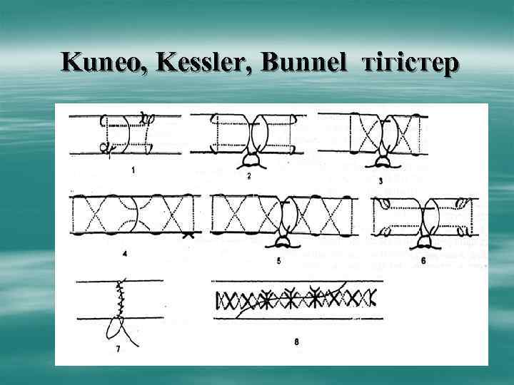 Kuneo, Kessler, Bunnel тігістер 