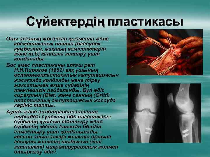 Сүйектердің пластикасы Оны ағзаның жоғалған қызметін және косметикалық пішінін (бассүйек күмбезінің, жақтың кемістіктерін және