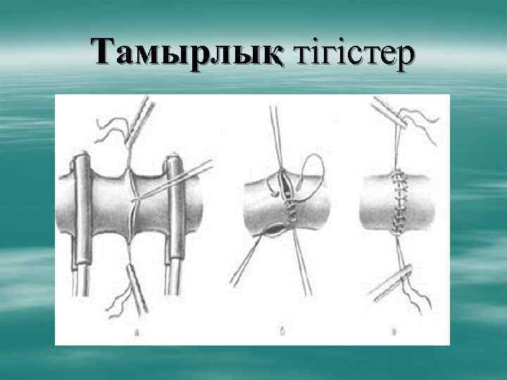 Тамырлық тігістер 