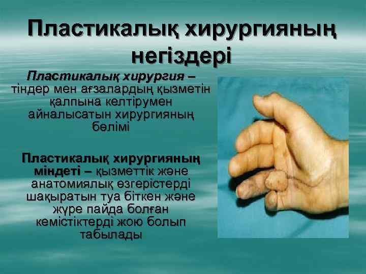 Пластикалық хирургияның негіздері Пластикалық хирургия – тіндер мен ағзалардың қызметін қалпына келтірумен айналысатын хирургияның