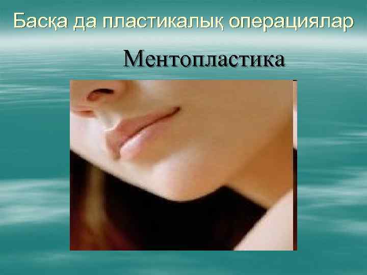 Басқа да пластикалық операциялар Ментопластика 