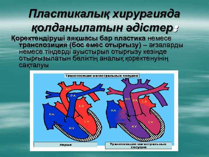 Пластикалық хирургияда қолданылатын әдістер: Қоректендіруші аяқшасы бар пластика немесе транспозиция (бос емес отырғызу) –