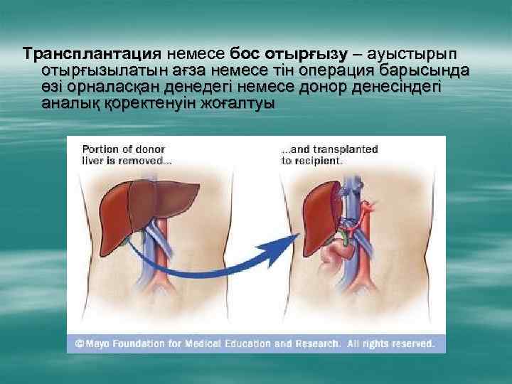 Трансплантация немесе бос отырғызу – ауыстырып отырғызылатын ағза немесе тін операция барысында өзі орналасқан
