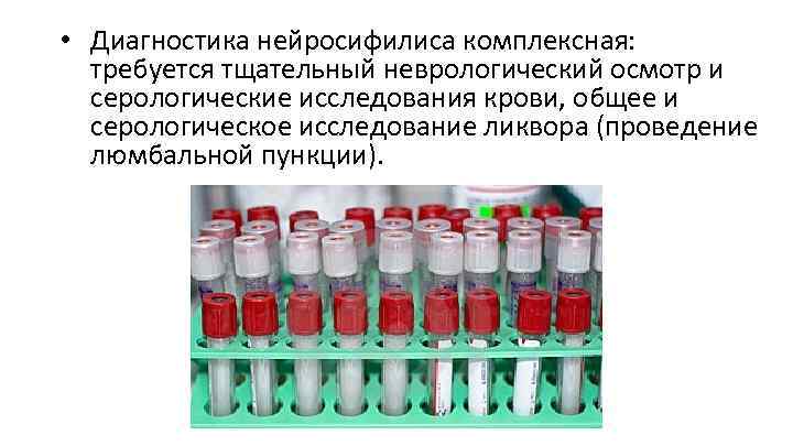  • Диагностика нейросифилиса комплексная: требуется тщательный неврологический осмотр и серологические исследования крови, общее
