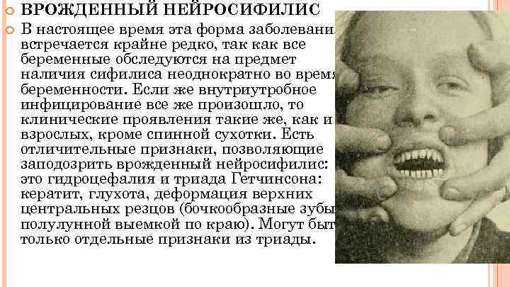  ВРОЖДЕННЫЙ НЕЙРОСИФИЛИС В настоящее время эта форма заболевания встречается крайне редко, так как