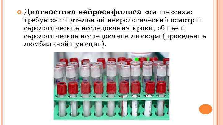  Диагностика нейросифилиса комплексная: требуется тщательный неврологический осмотр и серологические исследования крови, общее и