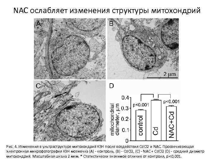 NAC ослабляет изменения структуры митохондрий Рис. 4. Изменения в ультраструктуре митохондрий КЗН после воздействия