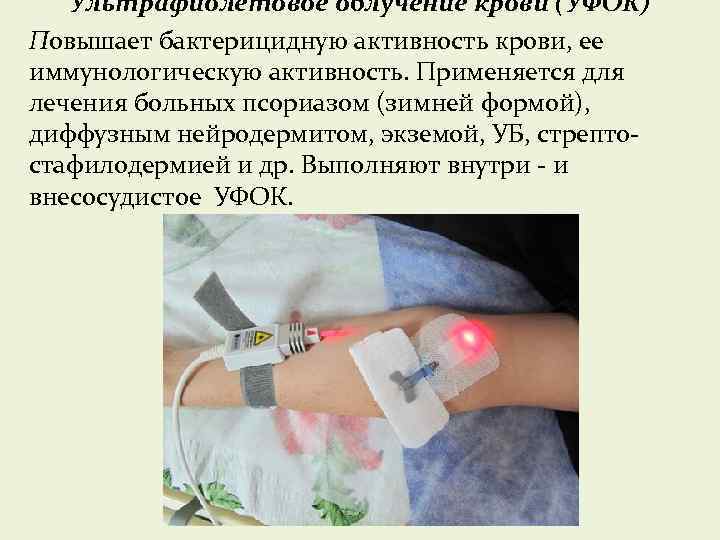 Ультрафиолетовое облучение крови (УФОК) Повышает бактерицидную активность крови, ее иммунологическую активность. Применяется для лечения