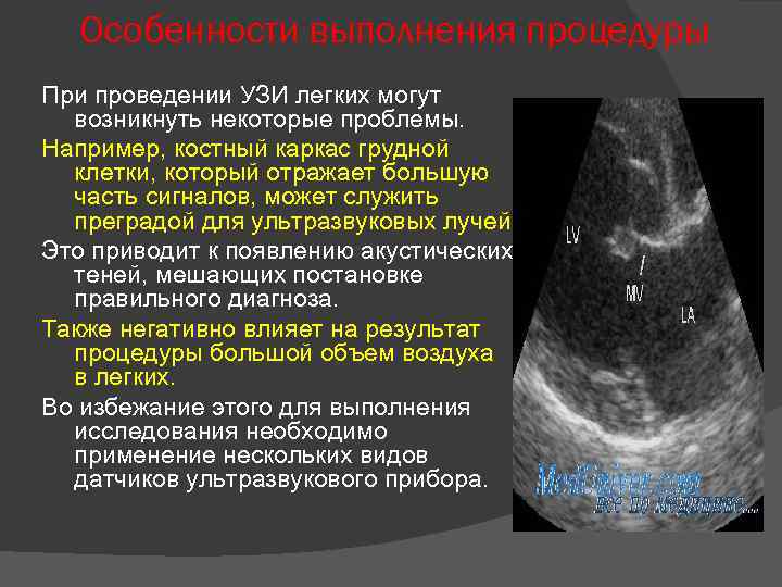 Особенности выполнения процедуры При проведении УЗИ легких могут возникнуть некоторые проблемы. Например, костный каркас