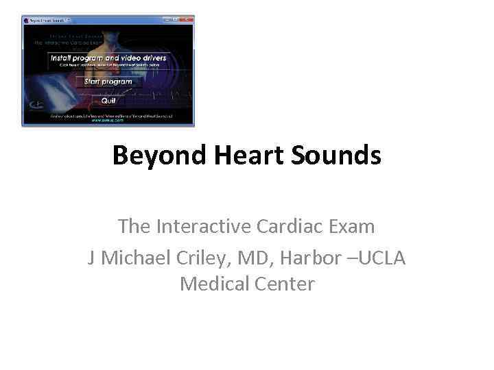 Beyond Heart Sounds The Interactive Cardiac Exam J Michael Criley, MD, Harbor –UCLA Medical