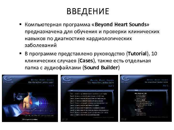 ВВЕДЕНИЕ § Компьютерная программа «Beyond Heart Sounds» предназначена для обучения и проверки клинических навыков