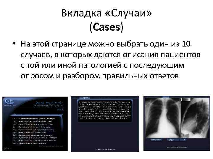 Вкладка «Случаи» (Cases) • На этой странице можно выбрать один из 10 случаев, в