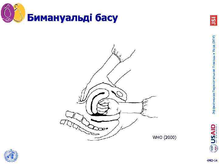 Эффективная Перинатальная Помощь и Уход (ЭПУ) Бимануальді басу WHO (2000) 4 MO-14 