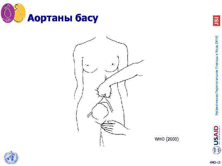 Эффективная Перинатальная Помощь и Уход (ЭПУ) Аортаны басу WHO (2000) 4 MO-15 