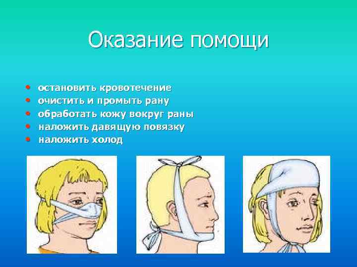 Оказание помощи • • • остановить кровотечение очистить и промыть рану обработать кожу вокруг