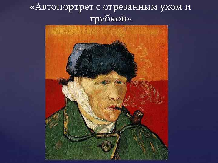 «Автопортрет с отрезанным ухом и трубкой». 1889 Г.. Винсент Ван Гог автопортрет с отрубленным ухом. Винсент с отрезанным ухом. Композитор отрезавший ухо.