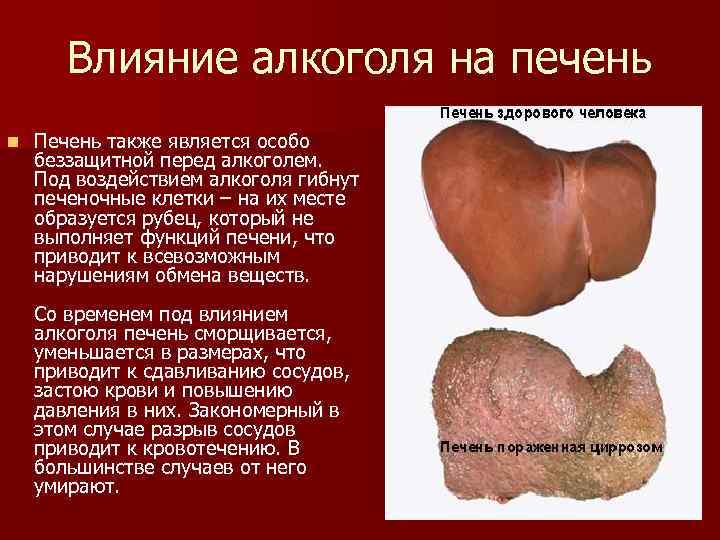 Влияние алкоголя на печень n Печень также является особо беззащитной перед алкоголем. Под воздействием
